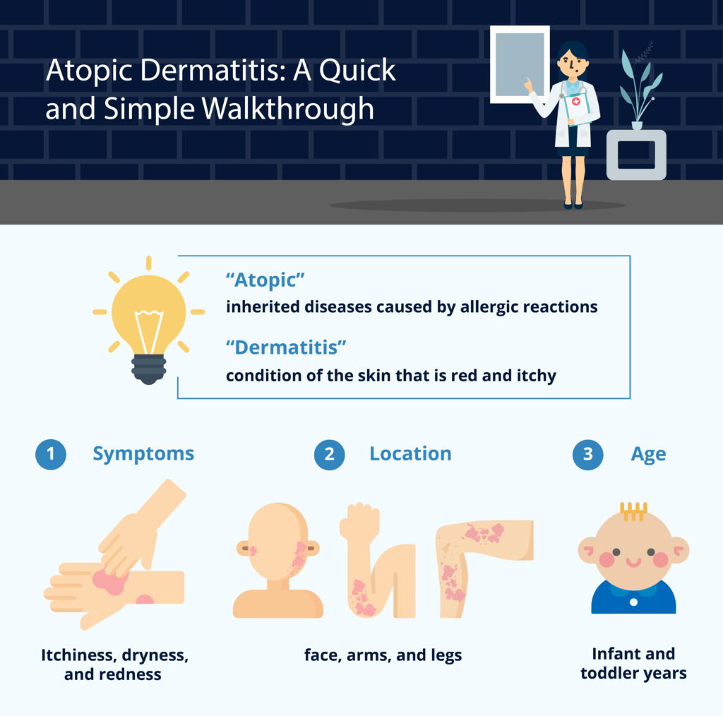 atopic dermatitis causes