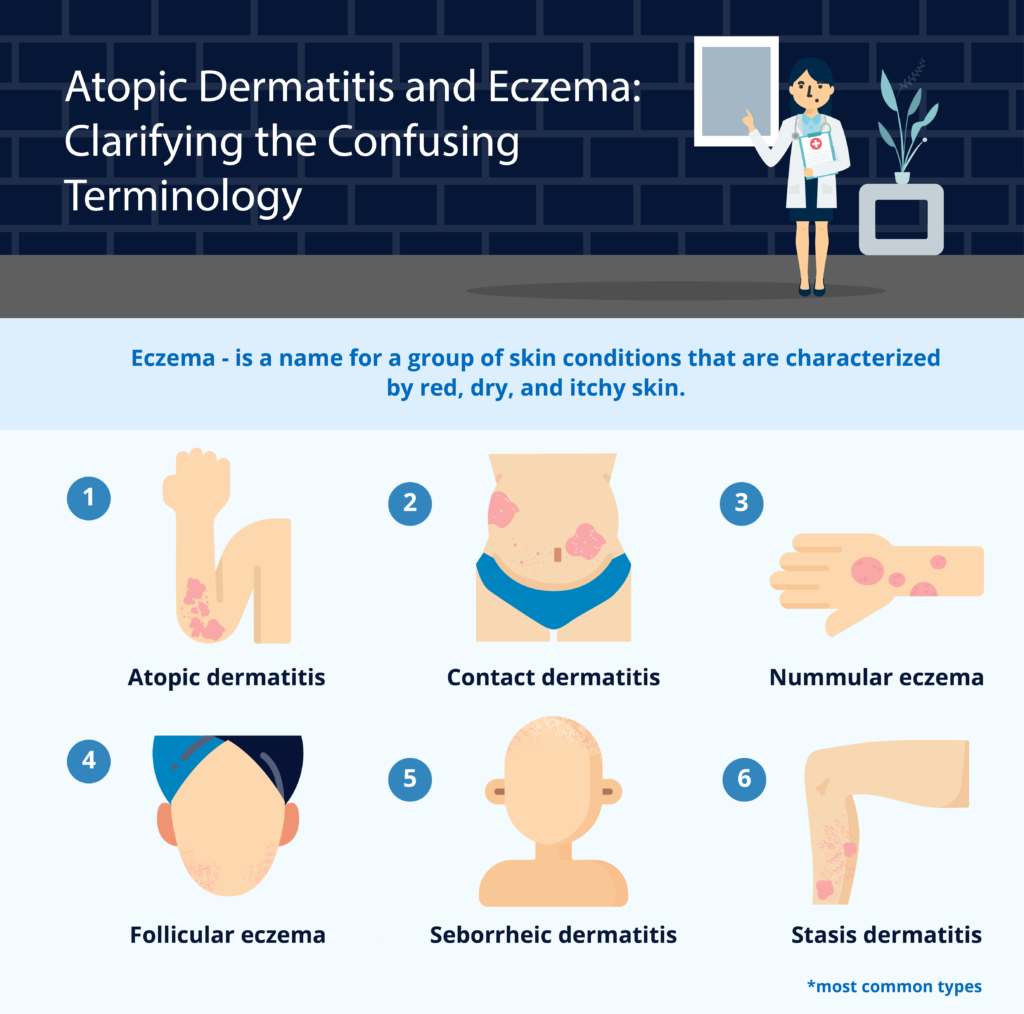 Atopic-Dermatitis-and-Eczema-Clarifying-the-Confusing-Terminology