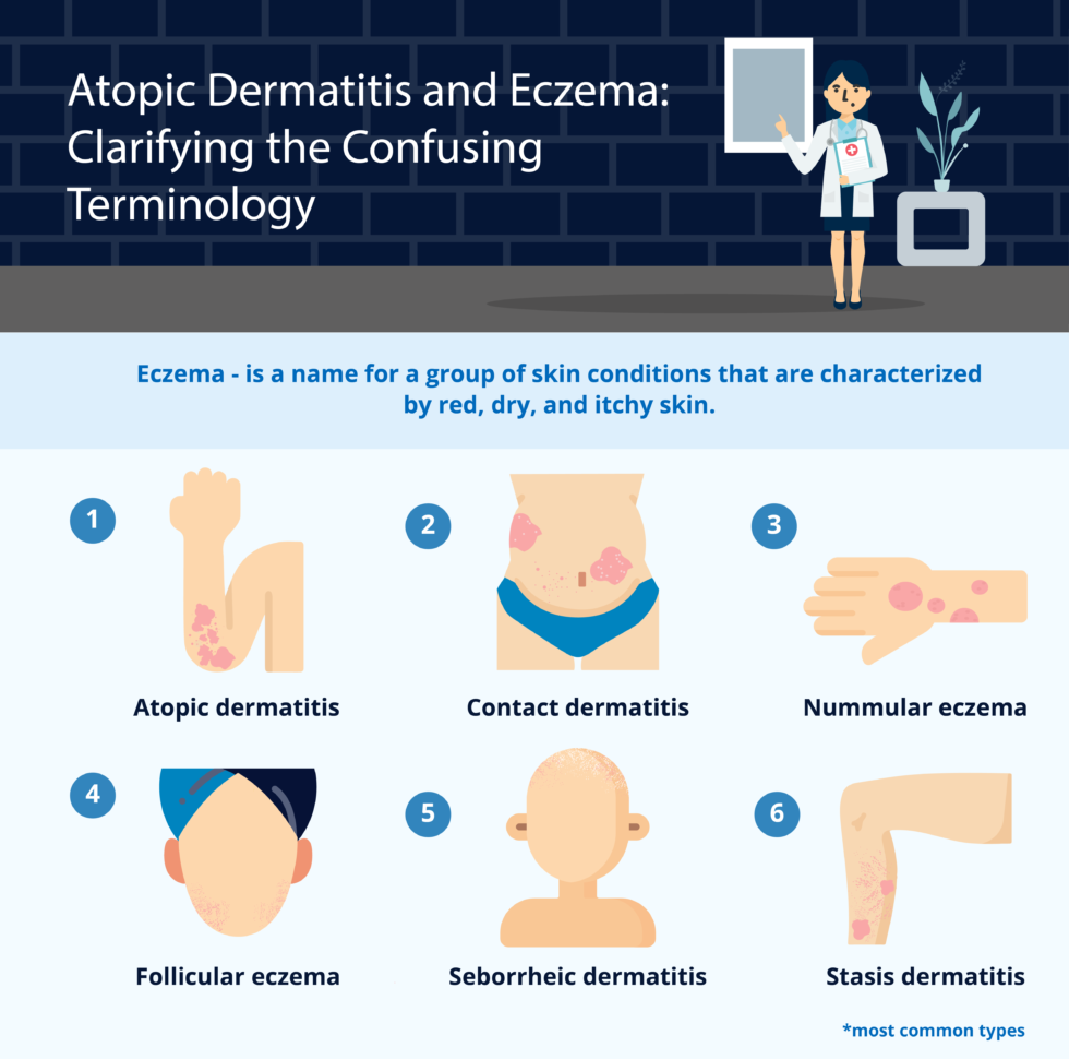 Eczema And Atopic Dermatitis Clarifying The Terminology